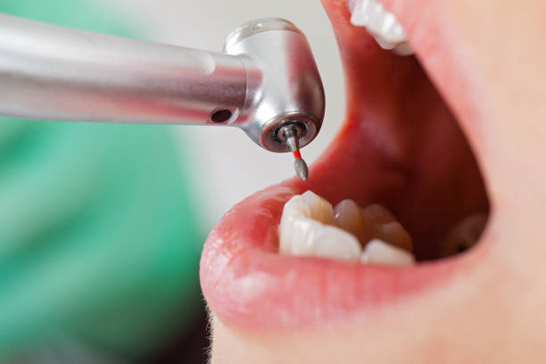 Best Knocked-Out Tooth Emergency  in East Islip, NY